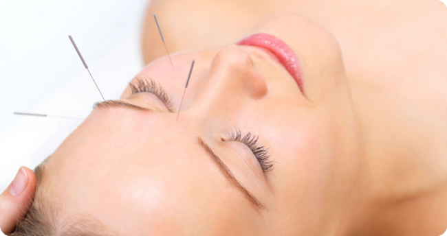 acupuncture-face_副本.png